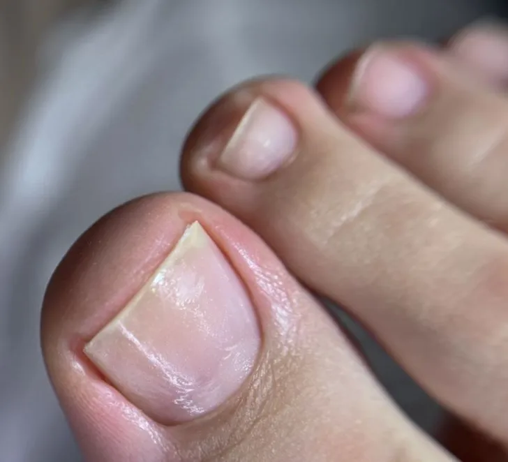 pedicura en gijon
